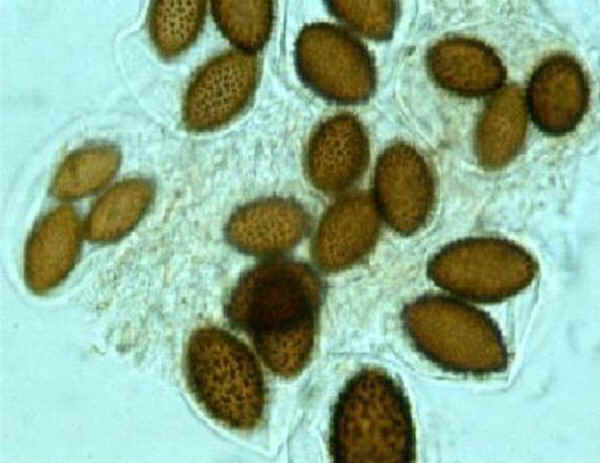 Aschi e spore di Tuber melanosporum Vittad.